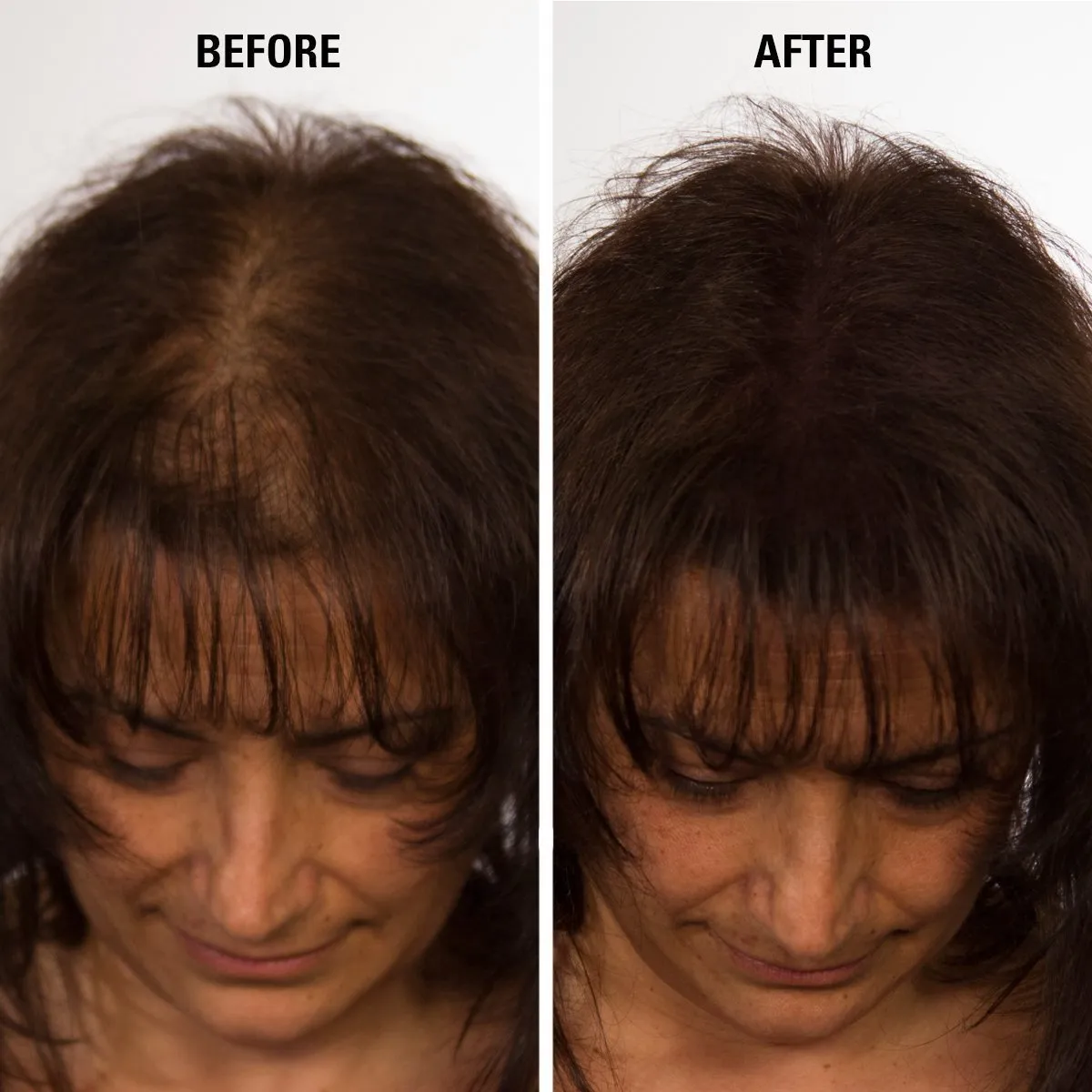 Hair for Women & Men to Conceal Hair Loss in 15 Seconds determination hub feat mushroom cipher postulate - 100% Undetectable Hair Building Fibers, 30g ECLIPSE Hair Fibers Black for Thinning 