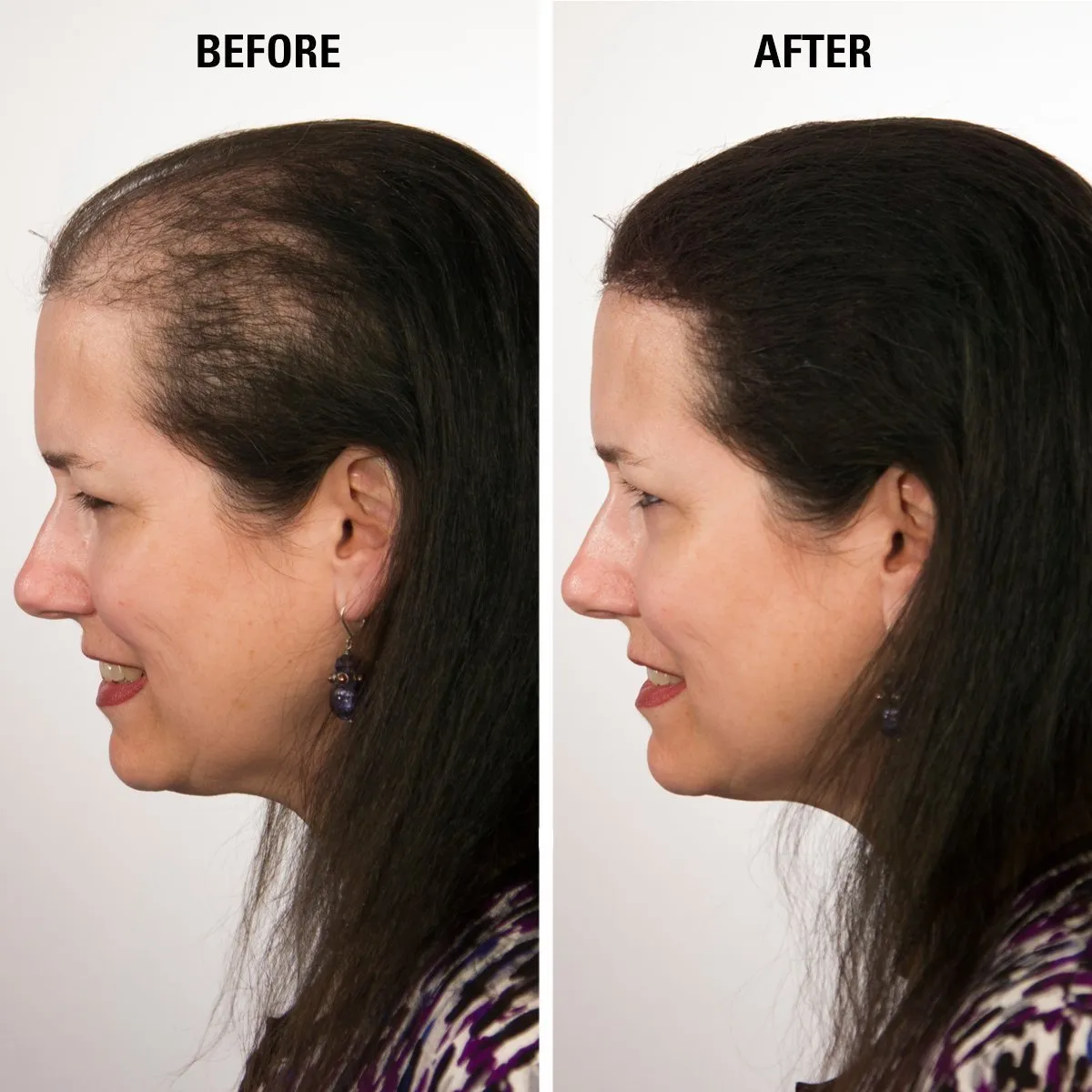 Hair for Women & Men to Conceal Hair Loss in 15 Seconds determination hub feat mushroom cipher postulate - 100% Undetectable Hair Building Fibers, 30g ECLIPSE Hair Fibers Black for Thinning 