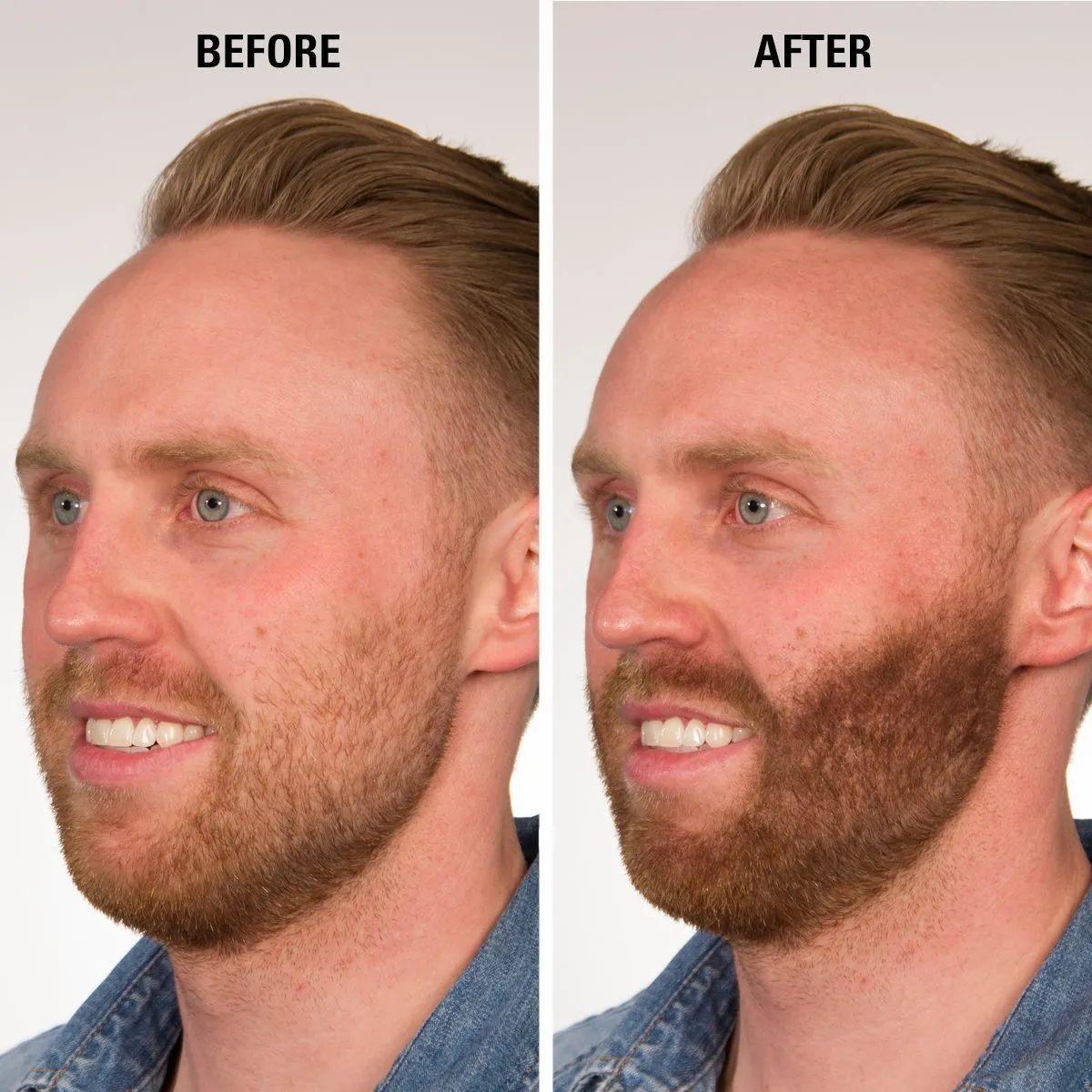 Hair for Women & Men to Conceal Hair Loss in 15 Seconds determination hub feat mushroom cipher postulate - 100% Undetectable Hair Building Fibers, 30g ECLIPSE Hair Fibers Black for Thinning 