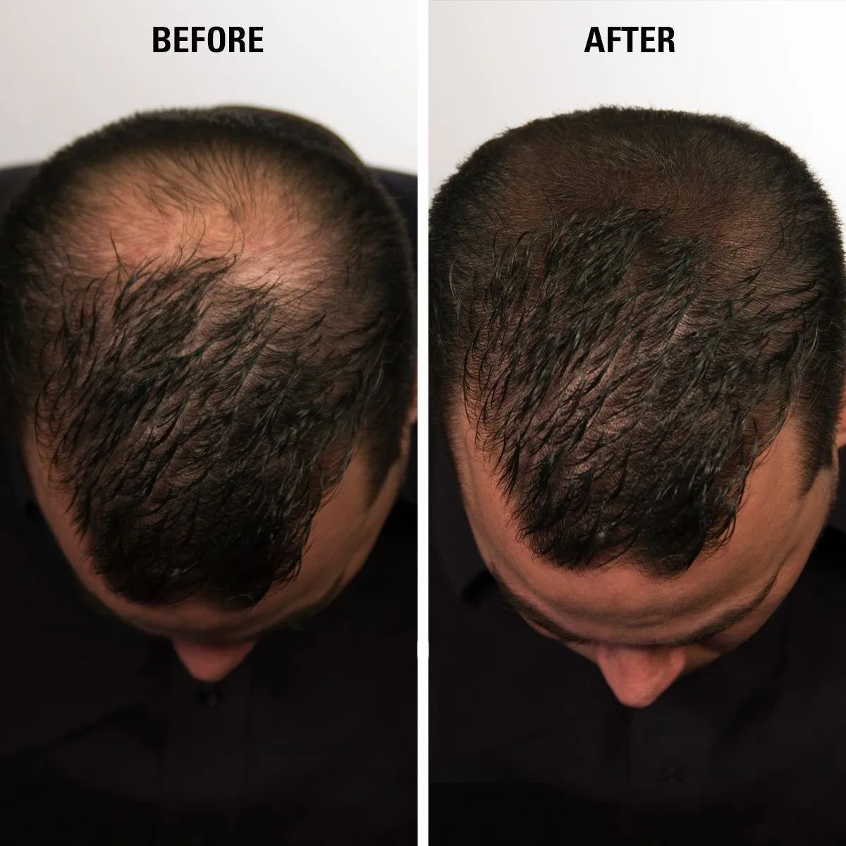 Hair for Women & Men to Conceal Hair Loss in 15 Seconds determination hub feat mushroom cipher postulate - 100% Undetectable Hair Building Fibers, 30g ECLIPSE Hair Fibers Black for Thinning 