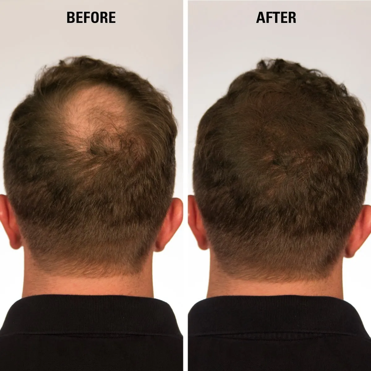 Hair for Women & Men to Conceal Hair Loss in 15 Seconds determination hub feat mushroom cipher postulate - 100% Undetectable Hair Building Fibers, 30g ECLIPSE Hair Fibers Black for Thinning 